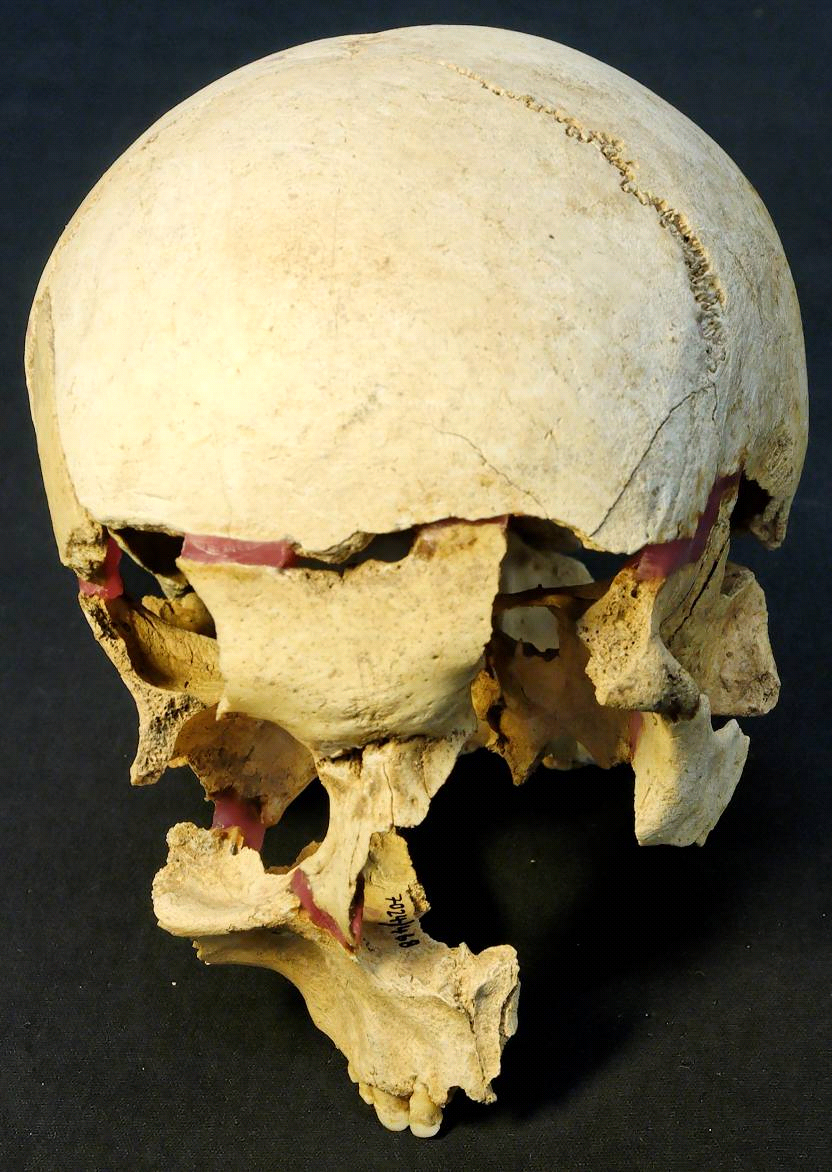 Anpassungen unterer Schdelfragmente an eine Kalotte aus Komplex 9